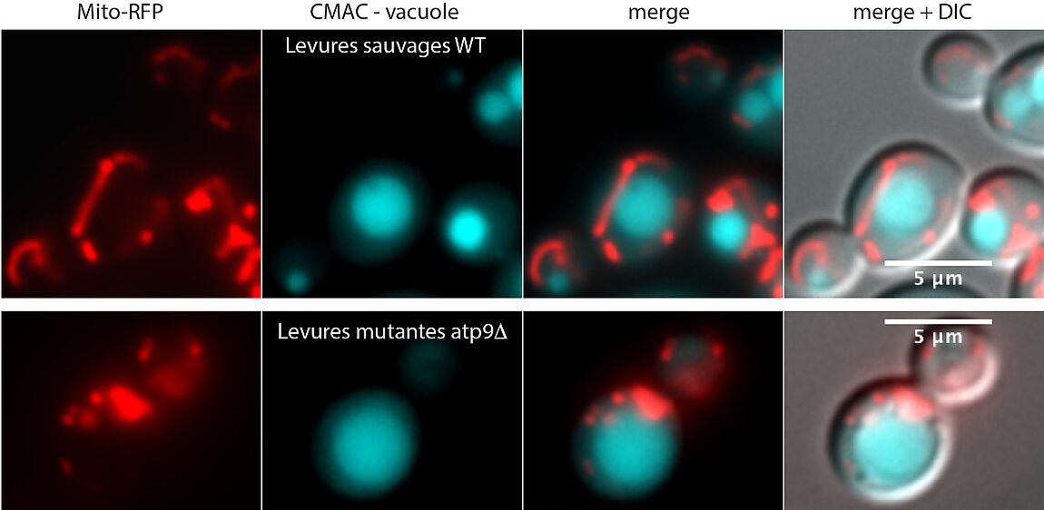 Observation par microscopie à fluorescence sur des cellules vivantes du réseau mitochondrial (en rouge) et de la vacuole (en bleu) dans des levures sauvages et mutantes pour l'ATP synthase mitochondriale atp9.